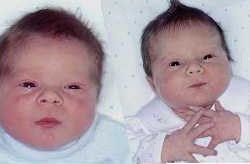 Side-by-side close up pictures of infant twins